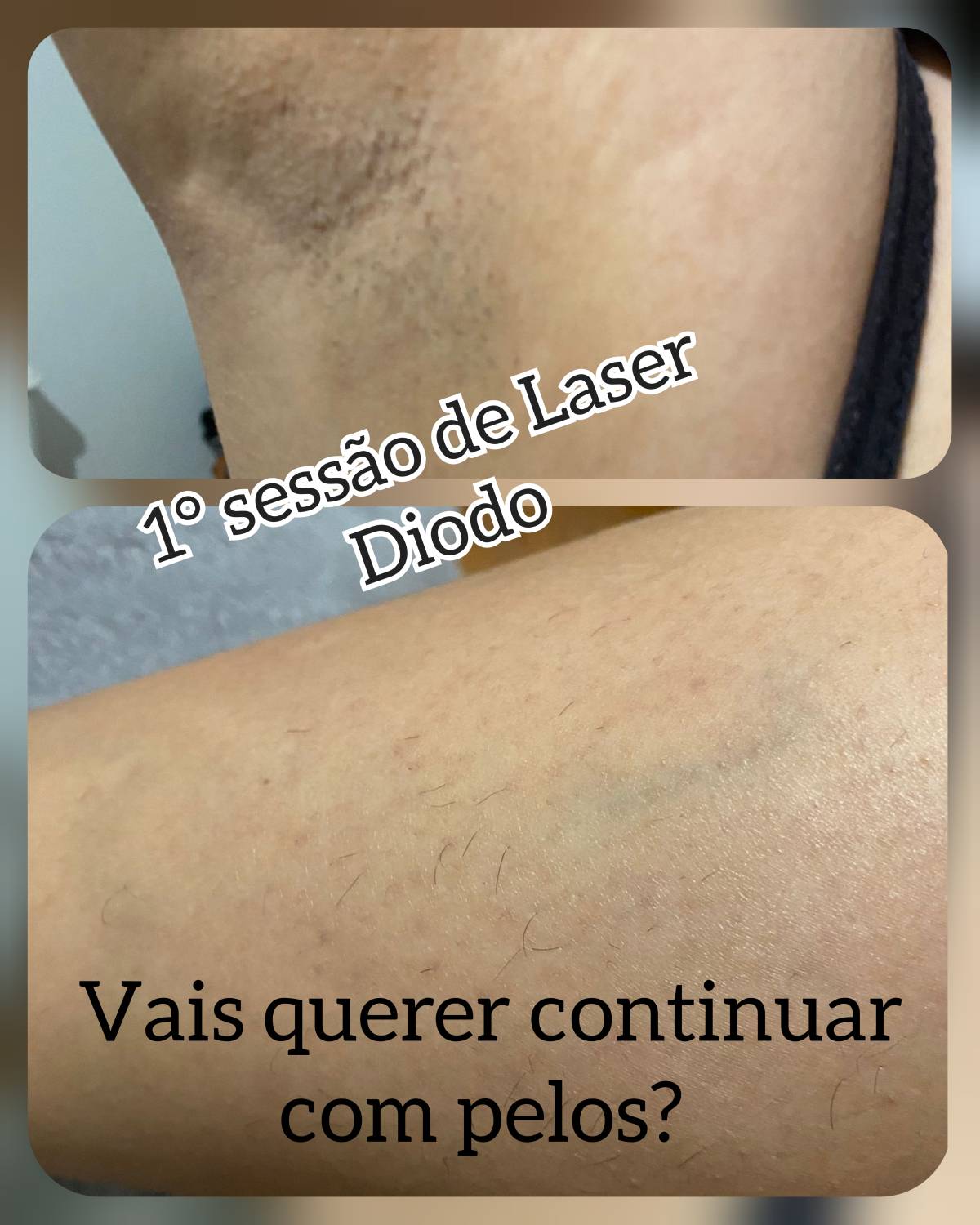 Mp nails marlene pereira - Seixal - Kosmetikerin
