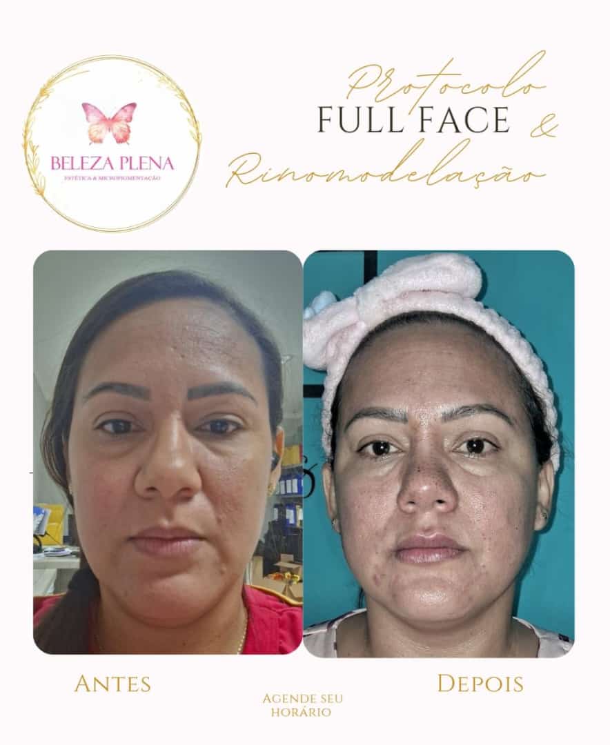 Danielle Oliveira - Setúbal - Depilation Services