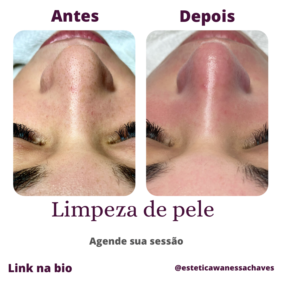 Vanessa chaves - Cascais - Facial