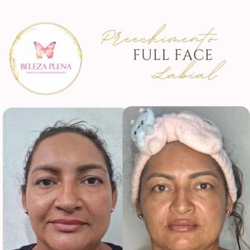 Danielle Oliveira - Setúbal - Skin Cleansing