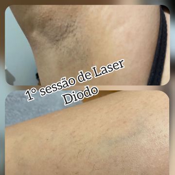 Mp nails marlene pereira - Seixal - Kosmetikerin