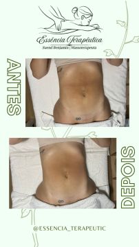 Suend Benjamin - Gondomar - Sports Massage