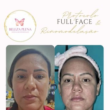 Danielle Oliveira - Setúbal - Depilation Services