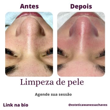 Vanessa chaves - Cascais - Facial